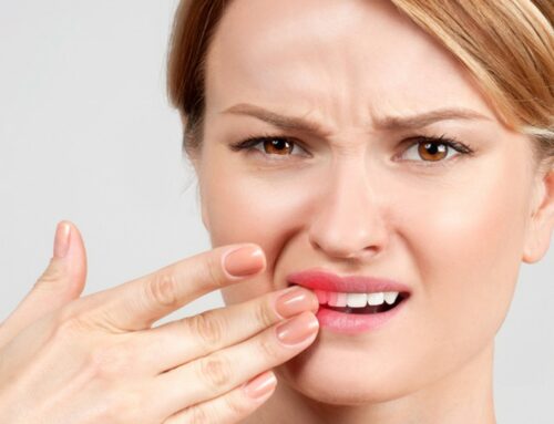 Come comportarsi con un dente rotto?